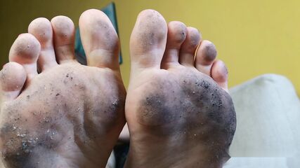 Dirty Feet